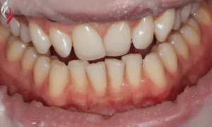 week-29-gif-shifnal-dental-care