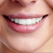 Teeth Whitening Aftercare Advice